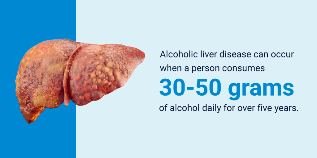 How Many Years of Drinking Can a Person Engage in Before Liver Damage Occurs?